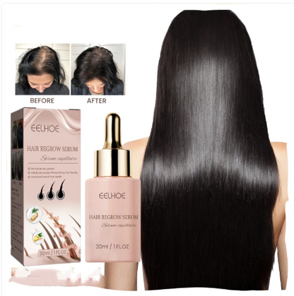 EELHOE Anti-hair Loss And Hair Nutrition
